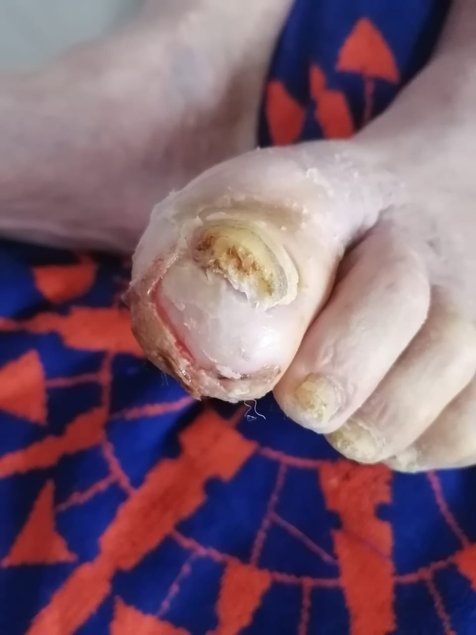 Photo shared with us, early stage